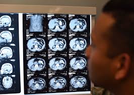 man in front of illuminated MRI scans